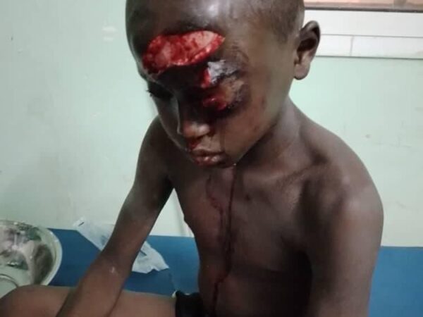 نجاة طفل هاجمه فرس نهر جنوبي موريتانيا