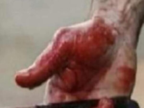 Un jeune homme poignardé à Toujounine  Un jeune homme a été grièvement blessé ce samedi soir après avoir reçu plusieurs coups de couteau dans le quartier militaire de Toujounine, à l’est de la capitale.