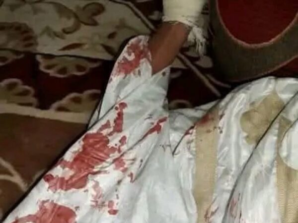 Agression à l’arme blanche près d’une mosquée