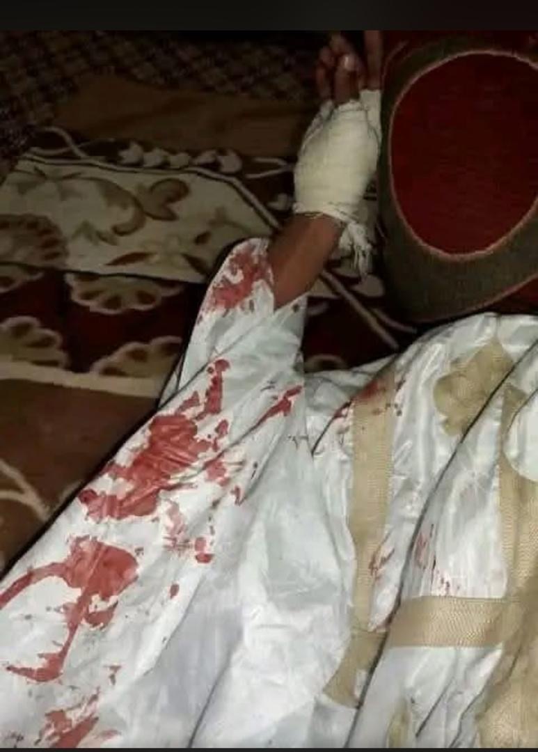 Agression à l’arme blanche près d’une mosquée