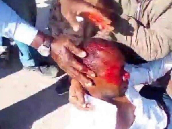 Affrontements à Zaatar : trois blessés admis à l’hôpital Cheikh Zayed