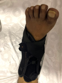 عندما يرهق ألم الجسد سلام الروح: قصة عقيد يحارب أخطاء الطب لاستعادة حركته